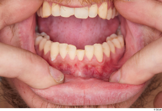 Sigvid teeth 0003.jpg